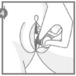 canesten tablet met applicator inbrengen stap 4